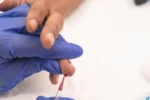 رایگان شدن تست PCR هپاتیت C در رفسنجان